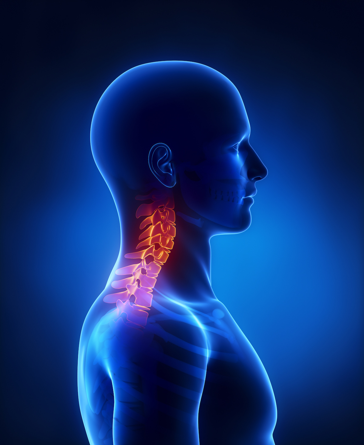 What Is Cervical Spine Trauma